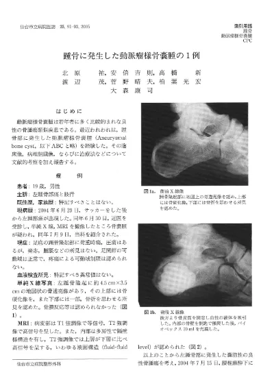 踵骨に発生した動脈瘤様骨嚢腫の１例